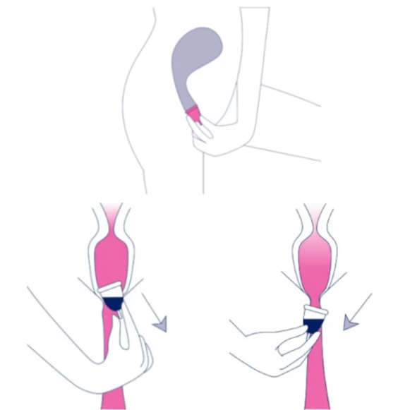 Retirar y vaciar V-Cup